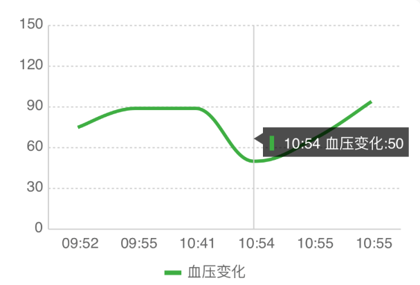 曲线图是什么样子的？曲线图是什么模型？